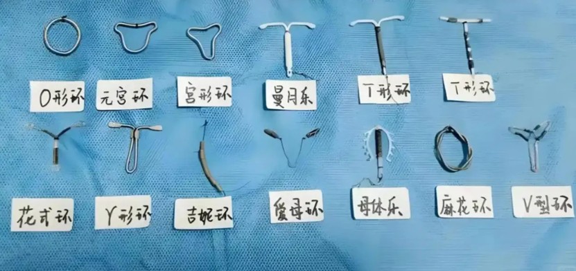 避孕器費用全攻略：銅T、蜜蕊娜、皮下避孕器價格與使用年限